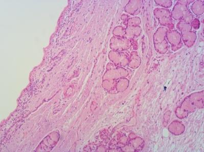 Figure 7: Trachea (HEx40).