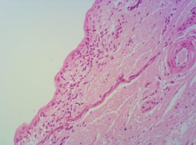 Figure 8: Trachea (Hex100).