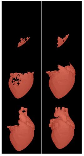Figure 13: Heart generation steps by cells as cellular automata belonging to ordinary triangles (POV-Ray 3.7 rendering). VIEW ANIMATION (requires internet connection) Thermodynamics, which compels any matter-energy system towards disorder and thermal equilibrium. Even if, locally, some partially ordered structures may emerge, by chance, the probability of such an occurrence is very small and the entire age of the universe would not be enough to produce an organized system comparable to the living beings which actually we observe on our planet. The number of the ordered possible combinations of particles is too small compared with the huge number of disordered combinations. Moreover, even if an ordered configuration might occur by chance, its stability in time would be even more and more unlikely. A further governing principle like information, which is neither matter nor energy (according to N. Wiener) seems to play an essential role in the process of order and organized systems emergence from matter. We have shown how algorithmic information (in the sense we have proposed just in sec. 2) can operate in order to generate complex systems either starting from an already ordered sequence of initial conditions or starting from random initial conditions, leading to the same geometry of the resulting objects, as attractors towards which the evolutive trajectories are led thanks to information. Of special interest, in relation to biological systems, has been revealed cellular automata since they add to the driving algorithmic information the constraint that any daughter cell is located in contiguity with its mother cell. No matter if the choice of the near location of the daughter cell is chosen by chance. What is relevant is the role of the law (information) according to which the daughter cell is born. The techniques implemented, have been applied to a biological system like a human organ, e.g., the heart, in order to simulate the generation or regeneration of its tissue by a stem cell. We saw how a simple program (compressed string) allows to obtain only a rough model of an heart shape, while a true realistic anatomic shape seems to require to know the full (uncompressed) list of the co-ordinates localizing the single cells, even if they are schematically represented by small spheres. An intriguing question arises if a biological organ belonging to a living body can be generated by an algorithm which can be compressed within a relatively short program string, or if an incompressible string of data is required to describe each single cell or constituent part of the whole system. Is the DNA, and more generally the biological code responsible of a living body generation, more resemblant to a compressible or to an incompressible string of code? In principle one could guess to model the whole universe as a set of nested attractors. In the present investigation we have limited ourselves only to attack the problem of the emergence of complex boundary geometrical shapes of bodies (like a living organ) thanks to the concurrence of some information (i.e., something resembling an Aristotelian form). A More intriguing matter would be, beside that of the generation of the external and internal organized structure of complex systems, that of modeling their behavior along time, i.e., their dynamics. So timidly approaching the matter of their nature (in the Aristotelian Thomistic sense of the word, i.e., operational ability), together with the matter of their essence (i.e., existing ability as organized ordered structures). Further researches will be required in future to widen the present program of investigating the role of information (form) as an immaterial principle of organization and activity of matter-energy. We hope that the INTERS project on “Form and information” may offer a suitable context to develop such a stimulating search and will be able to provide some more relevant results.