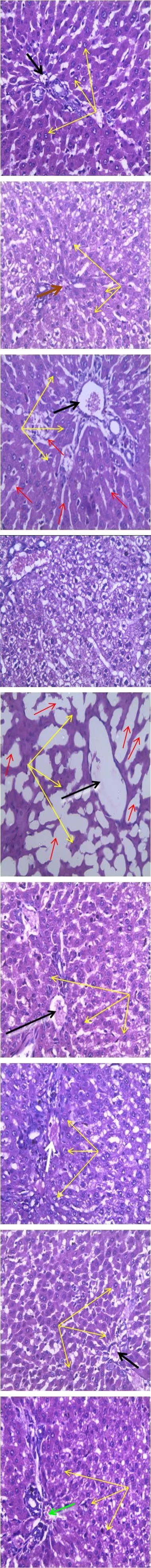 Figure 2: Average feed consumption throughout the experiment. Figures 3A – 3F: Figure A possesses radially arranged hepatocytes (yellow arrows) around the central vein (black arrow) but B shows various degrees of vacuolation (red arrow). Microscopically, coat of the central vein of figure C and E were thickened (brown arrow) and reduced central vein (brown arrow). However, F has disorganized outline with very few hepatocytes, but normal central vein (black arrow). All the figures apart from A and E possess vacuolated cytoplasm. Pb – Lead, LT- _Launaea_ _taraxacifolia,_ LTP- 100 mg/kg of _Launaea taraxacifolia_ before lead.