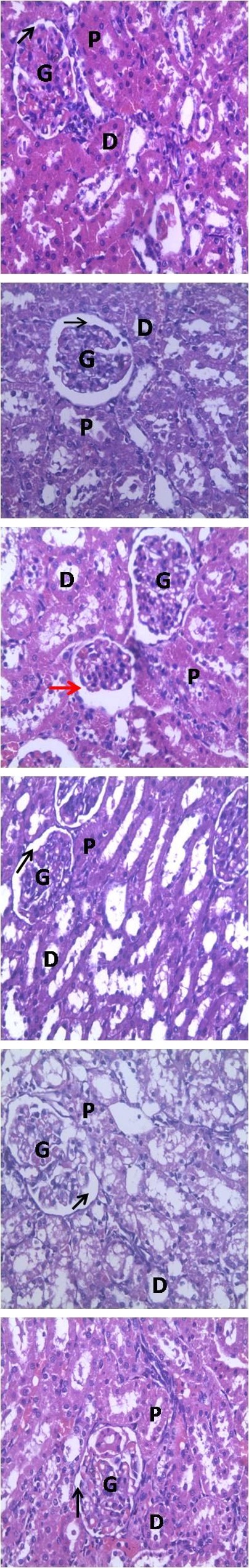 Figure 3: Photomicrograph of the Liver. X 400 (Contd). Figure 4A- 4F: All the slides show normal histo- architecture, no distortion. However, there was evidence of glomerular shrinkage (red arrow) shown by increase in Bowman’s space in Fig. 4B, while the other groups had intact Bowman’s capsular space (black arrow), glomeruli (G) with normal appearing distal (D) and proximal (P) convoluted tubules. Pb – Lead, LT - _Launaea taraxacifolia._