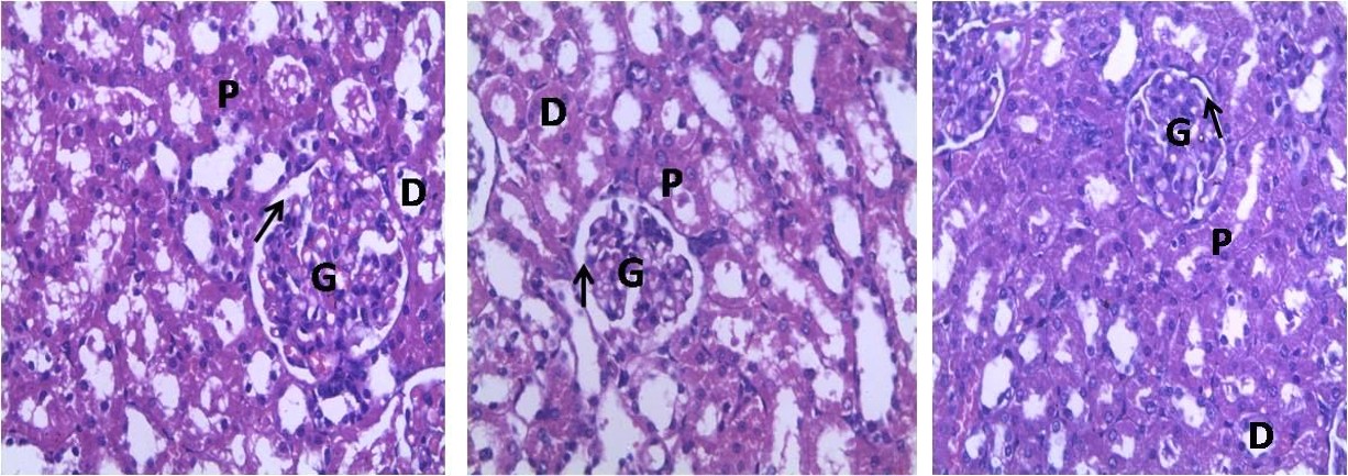 Figure 4: Photomicrograph of the kidney x 400. Figure 4G-4L: Apart from 4H, all the slides possess similar characteristic with no distortion of renal parenchyma, glomeruli (G) were intact with normal Bowman’s capsule (Black arrows). Pb - Lead, LT– Launaea taraxacifolia, DMSA – Dimecaptosuccinic acid, VC –Vitamin C or ascorbic acid.