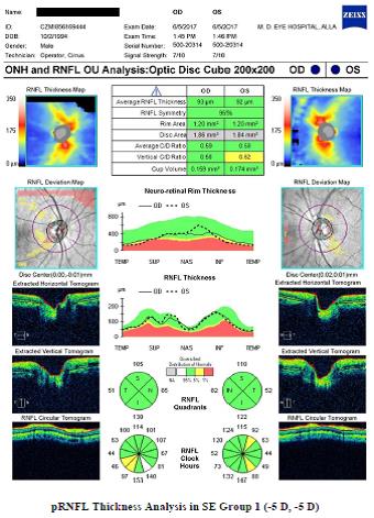 Figure 9: pRNFL Thickness Analysis in SE Group 1 (-5 D, -5 D).