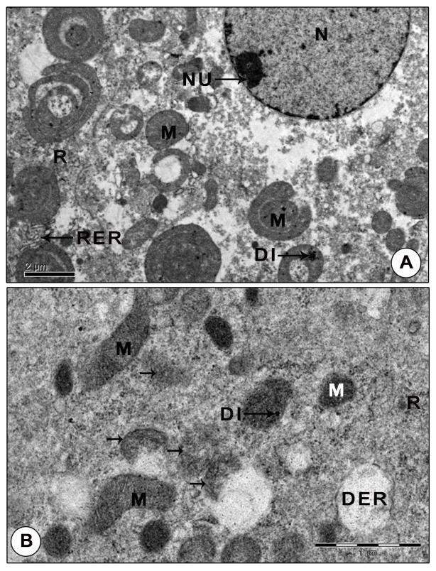 Figure 10: Ultrastructure of mandibular organ during post-reproductive phase (April). (A) Gland cell showing polymorphic mitochondria with indistinct cristae, sparsely distributed free ribosomes and narrow tubular RER cisternae. (B) Mitochondria with indistinct cristae and limiting membrane showing signs of inactivity. DER: Dilated RER cisternae; DI: Dense inclusions; M: Mitochondria; N: Nucleus; NU: Nucleolus; R: Ribosomes; RER: Rough endoplasmic reticulum. Arrows indicates degenerating mitochondria.