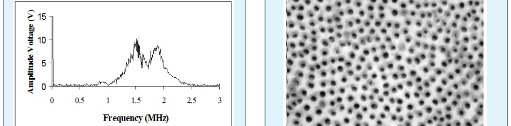Figure 9: SEM micrograph of dentine sample (20µm magnification).