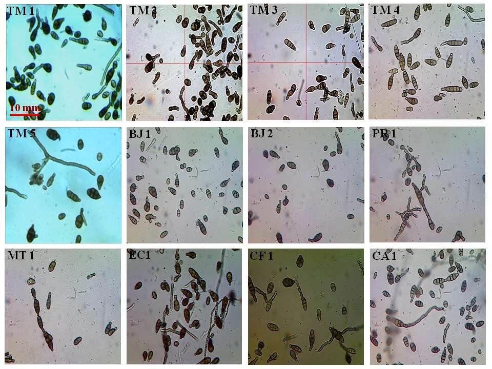 Figure 2: Microscopic view of conidia of different Alternaria alternata isolates; scale bar represents 10 mm.
