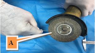 Figure 5: Using of the food grate stainless steel rods in the fixation of the xeno sheep bony implantation in the rabbit’s femoral bones.