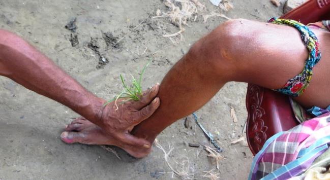 Figure 12: Venom coming down after administration of leaf juice (note position of ‘ojhas’ hand).
