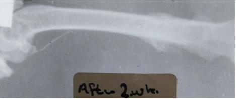 Figure 11: Radiographic image eight week p.o. and two week after the removing FGSR two months p.o. show well alignment of the two femoral fragments thickening endostium with increased density of the new bone formation.