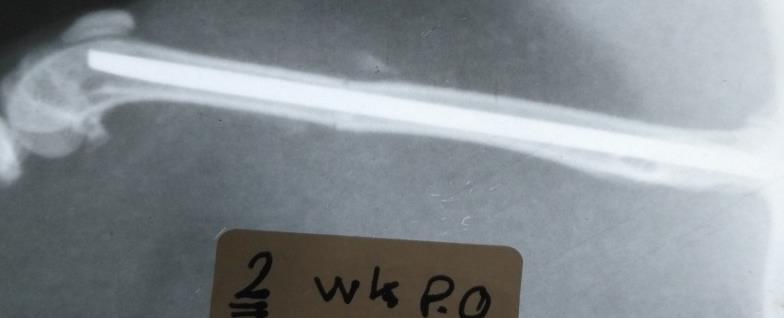 Figure 6: Radiographic image at the end of second week p.o. revealed new bone formation visible radiographically from the cortex of the proximal and distal fragments toward the fracture line, the fracture line still visible with smooth end.