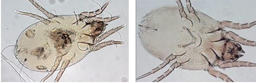 Figure 1: Common house dust mites: A: D. pteronyssinus (European House Dust Mite) and B: D. farinae (American House Dust Mite).