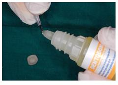 Figure 7: Application of the hydrofluoric acid to etch the inner surface then applying a silane.
