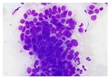 Figure 11: Mitotic spindle formation in lymphoma cells.