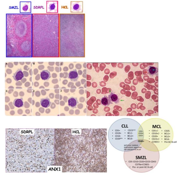 Figure 23: Normal Acinar component with few inflammatory cells.