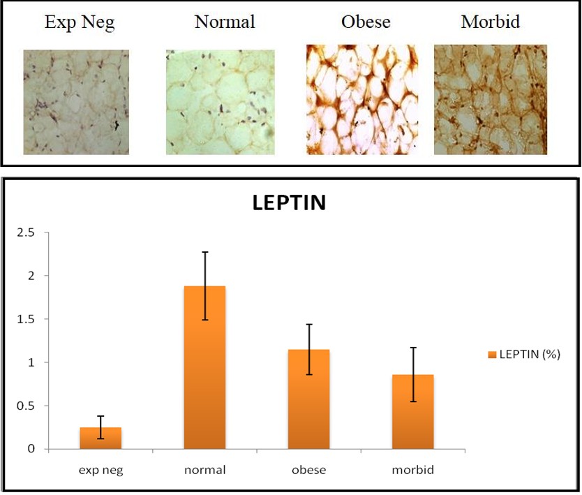 Figure 2: Both leptin and triacylglycerol were increased as obesity advanced. A positive correlation was found between leptin and triacylglycerol with the progress of obesity.