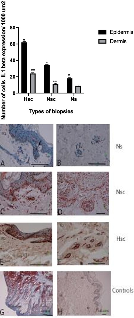Figure 4: Quantitation of skin sections processed for ISH using DIG-labeled probes for TNF-α. The porcentage of cells exhibiting positive hybridization signal for mRNAs were counted in the epidermis and dermis. Error bars indicate S.E.M. * P≤ 0.05.