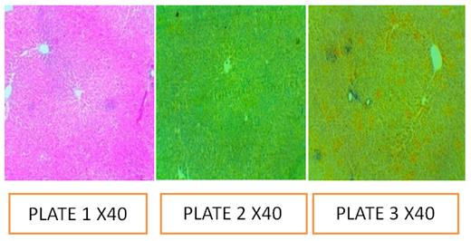 Figure 16: Plate 1: Control; Plate 2: pH 5.0; Plate 3: pH 7.5.