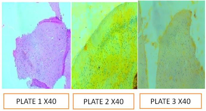 Figure 17: Plate 1: Control; Plate 2: pH 5.0; Plate 3: pH 7.5.