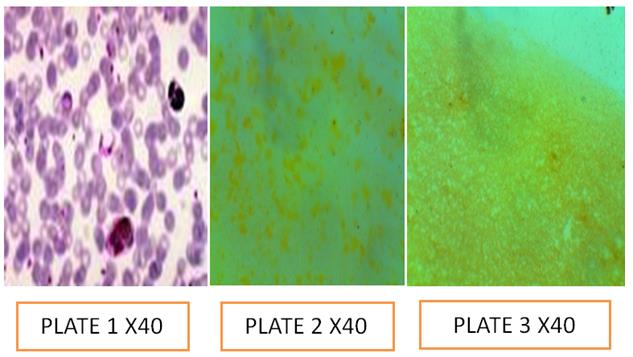 Figure 20: Plate 1: Control; Plate 2: pH 5.0; Plate 3: pH 7.