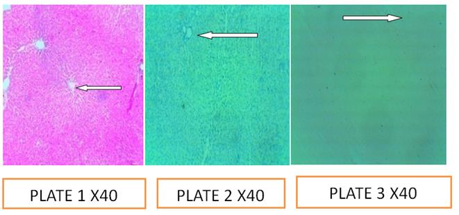 Figure 3: Plate1: Control; Plate 2: pH 5.0; Plate 3: pH: 7.5.