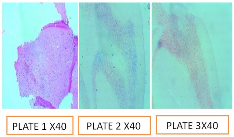 Figure 4: Plate1: Control; Plate 2: pH 5.0; Plate 3: pH: 7.5.