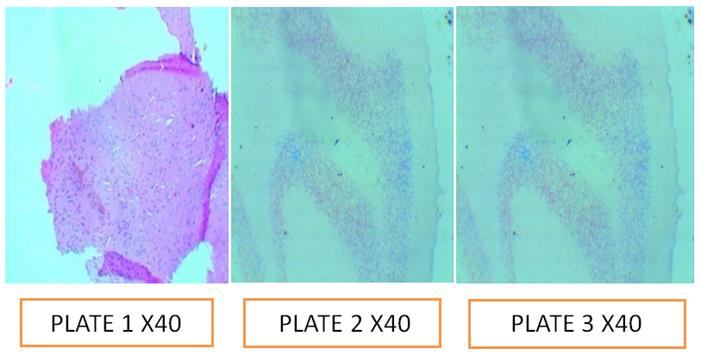 Figure 5: Plate1: Control; Plate 2: pH 5.0; Plate 3: pH: 7.5.
