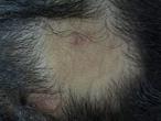 Figure 2: Microsporic tinea due to M. canis.