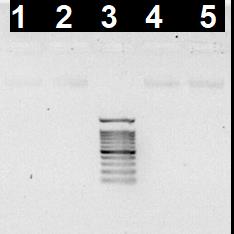 Figure 2: MIC result of _Enterococcus faecalis_ ATCC 51299_._ 1: 12.5 mg/ml, 2: 6.25 mg/ml, 3: 3.125 mg/ml, 4: 1.56 mg/ml, 5:0.781 mg/ml. Metamizole could not inhibited the growing of _Enterococcus faecalis._