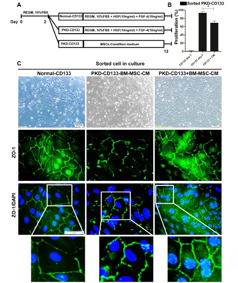 Figure 4: Cystogenic potential of CD133+ renal progenitor cells reduced by hBM-MSC-CM. A: Schematic plan for co-culture of the normal and polycystic CD133+ renal progenitor cells with and without MSC-CM. B: Proliferation rate of polycystic CD133+ renal progenitor cells were decreased by hBM-MSC-CM. C) In polycystic CD133+ renal progenitor cells, adherent junctions such as ZO-1 were increased by hBM-MSC-CM.