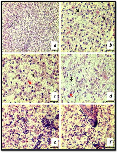 Figure 2: Histological biomarkers in liver of Aristichthys nobilis Rich. under the action of thiamethoxam, H&E [19]. a: Normal histological structure, x200 b: Granular degeneration at a concentration of 6.6 mg / L thiamethoxam, x400 c: Cacuolar and fatty degeneration at a concentration of 10 mg / L thiamethoxam, x400 d: Necrobiotic changes at a concentration of 20 mg / L thiamethoxam, x400 e: Lymphocytic proliferation at a concentration of 20 mg / L thiamethoxam, x400 f: Hyperemia at a concentration of 20 mg / L thiamethoxam, x400