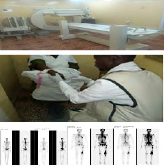 Figure 2: Patterns of Immunohistochemistry of Breast Cancer Patients.