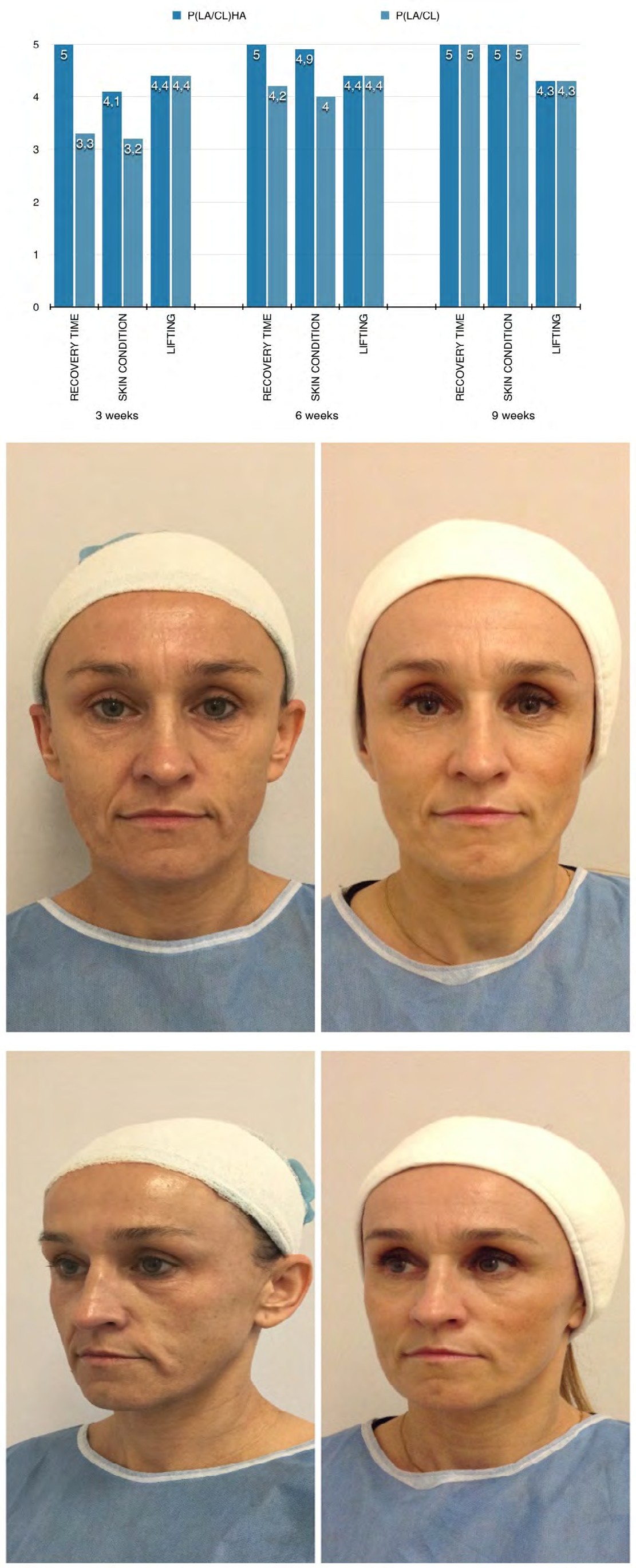 Figure 1: Patient age: 45.