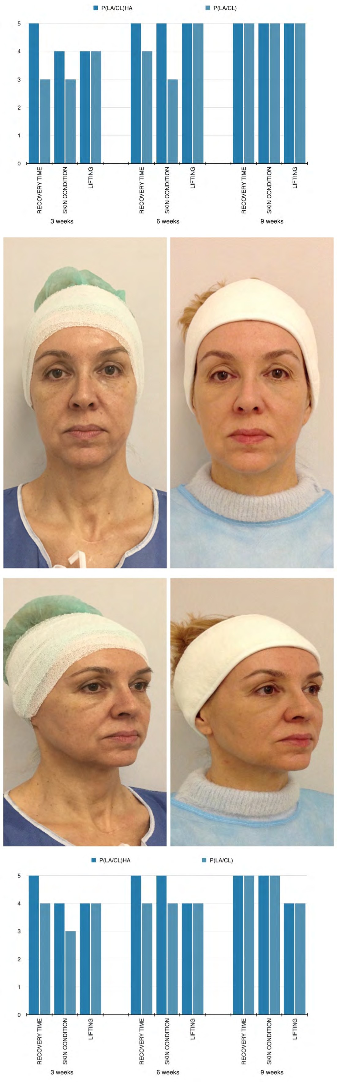 Figure 2: Patient age: 53.