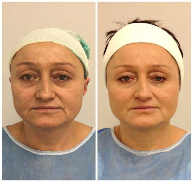 Figure 3: Patient age: 52.