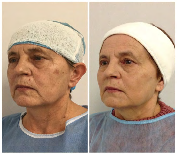 Figure 7: Patient age: 40.