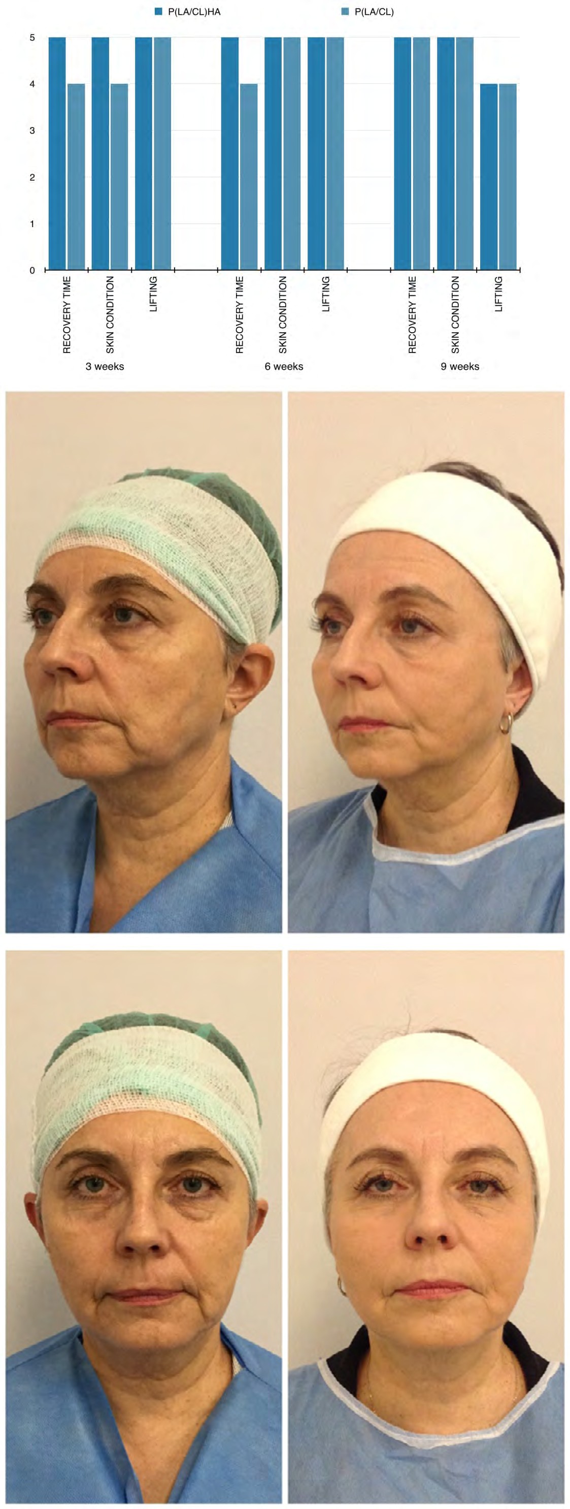 Figure 8: Patient age: 54.