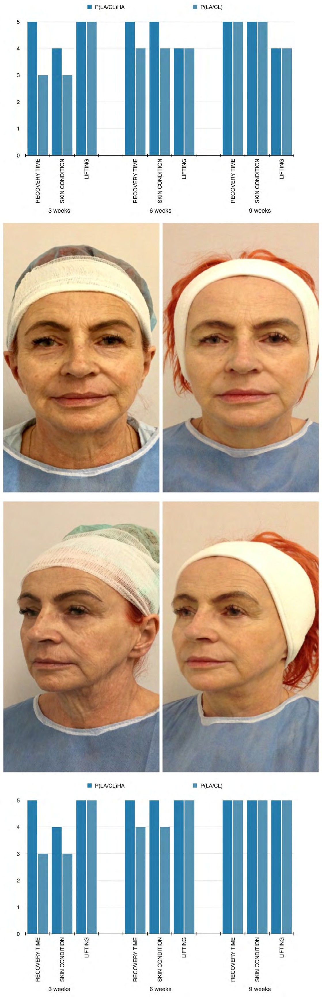 Figure 9: Patient age: 53.