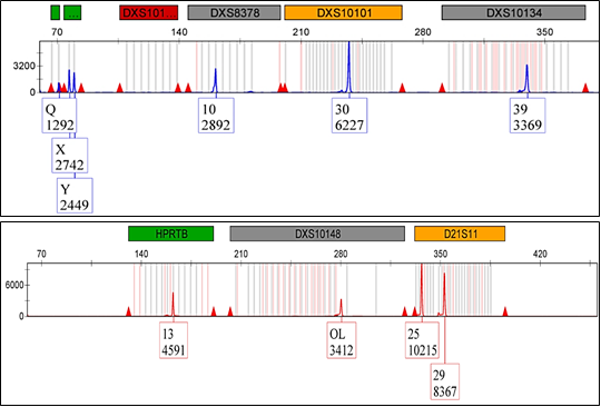 Figure 1: Non-standard and null cases observed in some samples.