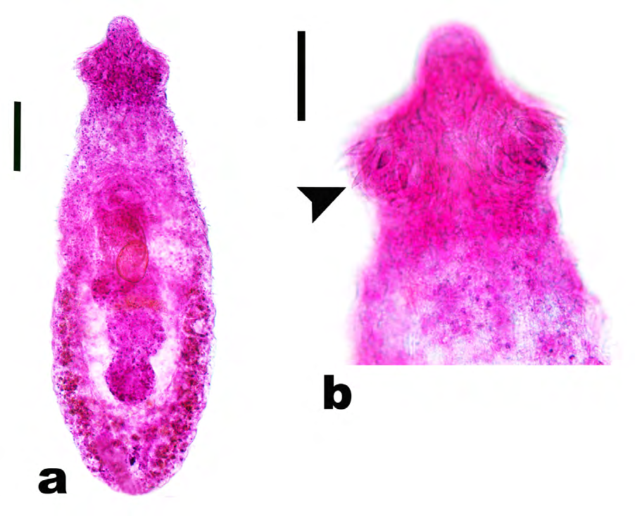 Figure 3: The revealed echinostomatid, Echinochasmus liliputanus. a: The whole adult worm. Scale bar= 100 μm. b: The anterior end of the worm showing a head collar armed with unequally sized collar spines arranged in a single dorsally interrupted row. Scale bar = 50 μm.