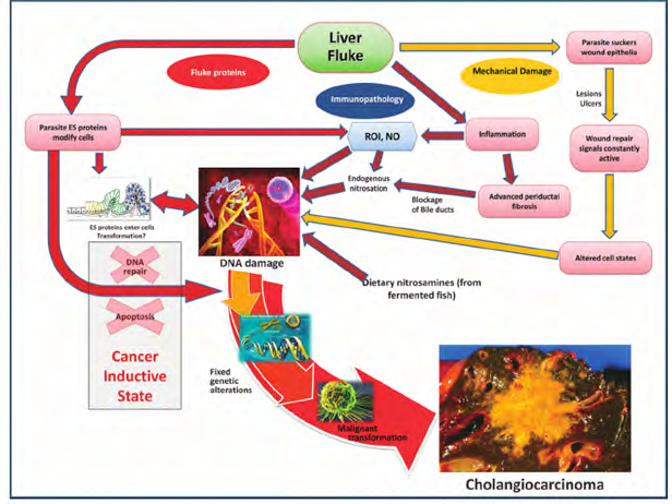 Figure 3: Hypothesized pathways of pathogenesis of opisthorchiasis-associated cholangiocarcinoma. Adapted from ref [36].