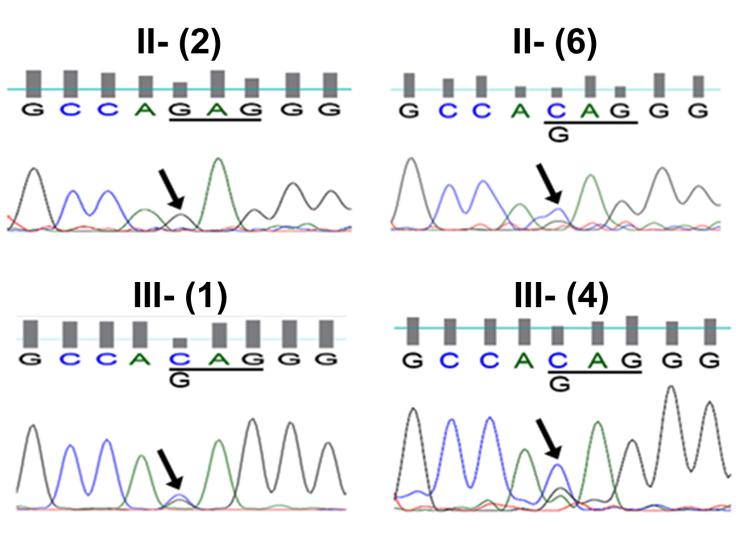 Figure 2: Chromatograms of DNA sequences show the association of a c.1102G>C transversion with the cataract phenotype in affected family members. The chromatogram from an unaffected individual (II-2) shows only the wild type GJA8 allele with G at position 1102. Sequence chromatograms from two affected family members (II-6 and III-1) and the proband (III- 4) show both C and G at position 1102. The mutant allele containing a G to C transversion would result in the substitution of glutamine for glutamate at amino acid residue 368 (E368Q). The seven other candidate genes did not show any pathogenic variations. The GJA8 transversion was not seen in an unaffected member of the family (paternal aunt, II-2). The mutation in GJA8 abolishes a restriction site for BspNCI. However, restriction site analysis using this enzyme could not be performed, because it is not commercially available. Therefore, all the control subjects (n = 100) were screened by direct sequencing of amplicons; the c.1102G>C transversion in GJA8 was not identified in any of them. Functional characterization The GJA8 gene encodes the gap junction protein Cx50 which forms intercellular channels in the lens. The c.1102G>C transversion would cause a substitution of glutamine for glutamate at position 368 (E368Q) in the cytoplasmic C-terminus of Cx50 (Figure 3).