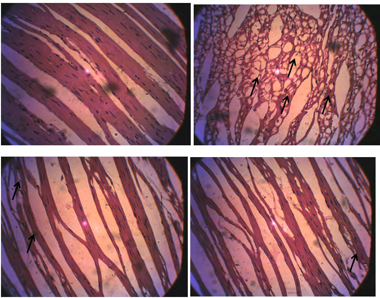 Figure 5: Photomicrograghs of section of cardiac tissues of rats administered Cypermethrin, vitamin C and E. A: control rats showing normal cardiac muscle fiber architecture with multiple elongated nuclei. The cardiac muscles are branched with less space between the muscle fibers. B: rats administered cypermethrin only showing damage histo architecture of the cardiac muscle characterized by severe vacuolization of cardiac muscle with no clear branching. C: rats administered cypermethrin + Vitamin C showing a fairly normal cardiac muscle branched and multinucleated. Areas of mild vacuolization are seen and enlarge intramuscular fiber space. D: rats administered cypermethrin + Vitamin E showing mild vacuolization and enlarged intramuscular fiber space. Cardiac muscle branched and multinucleated.