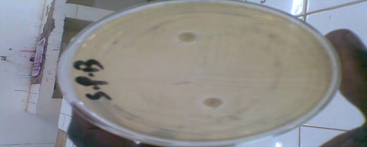 Figure 1: Inhibition Zone of Amoxicillin against Helicobacter Pylori.