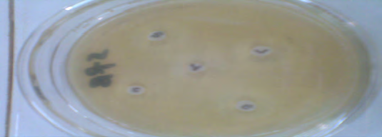 Figure 2: Inhibition Zone of Clarithromycin against Helicobacter Pylori which clear the Resistant.