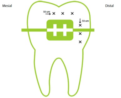 Figure 2: Post-Demineralization Vickers Microhardness.