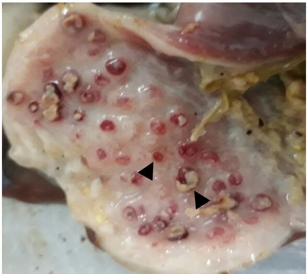 Figure 1: Hemorrhagic proventriculitis with focal areas of necrosis: a gross lesion (arrow heads) in Birds with Clinical Newcastle disease.