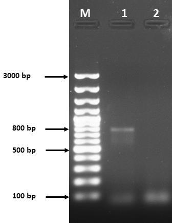 Figure 2: Agarose gel representing the PCR amplified F gene of approximately 800 bp (M: marker, lane 1: virus and lane 2: negative control).