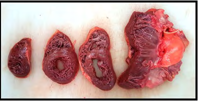 Figure 1: Cut section of the heart showing a grossly normal myocardium and valves. Myocardial architecture of the right ventricle wall and interventricular septum is unaffected.
