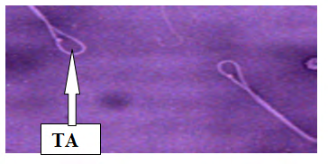 Figure 10: Plate VIII: Semen smears from Group 6 (100mg/ Kg bwt of Ketoconazole Tablets for five days and 0.36mg/ Kg bwt Mesterolone Tablet for thirteen days) Normal sperm morphology NSM (Eosin stain ×400).