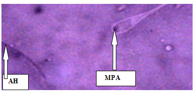 Figure 12: Plate X: Semen smears from Group 8(500mg/ Kg bwt of Ethanolic Extract of _Sesamum indicum_ seeds) sperm cell morphology (SCM) (Normal saline ×400).